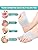 Vue 7 de Nimisyra Ortheses Hallux Valgus