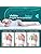 Vue 4 de Tenicore Orthese Hallux Valgus