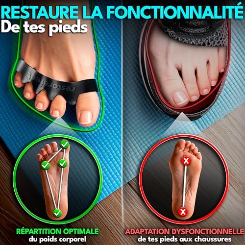 Vue 2 de Kit Separateur Dorteils Avec