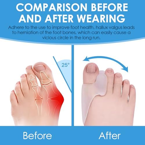 Vue 3 de Pieces Correcteur Hallux Valgus
