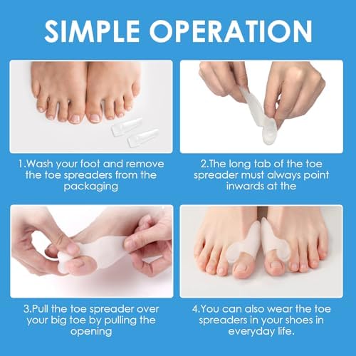 Vue 7 de Pieces Correcteur Hallux Valgus