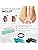 Vue 3 de Restorefeet Orthese Hallux Valgus