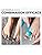 Vue 4 de Restorefeet Orthese Hallux Valgus