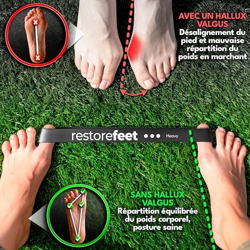 Vue 2 de Restorefeet Bandes De Resistance