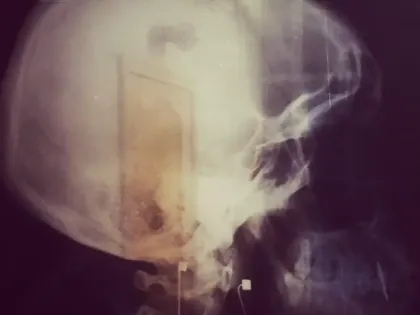 «Места в палатах есть, но за них нужно платить»