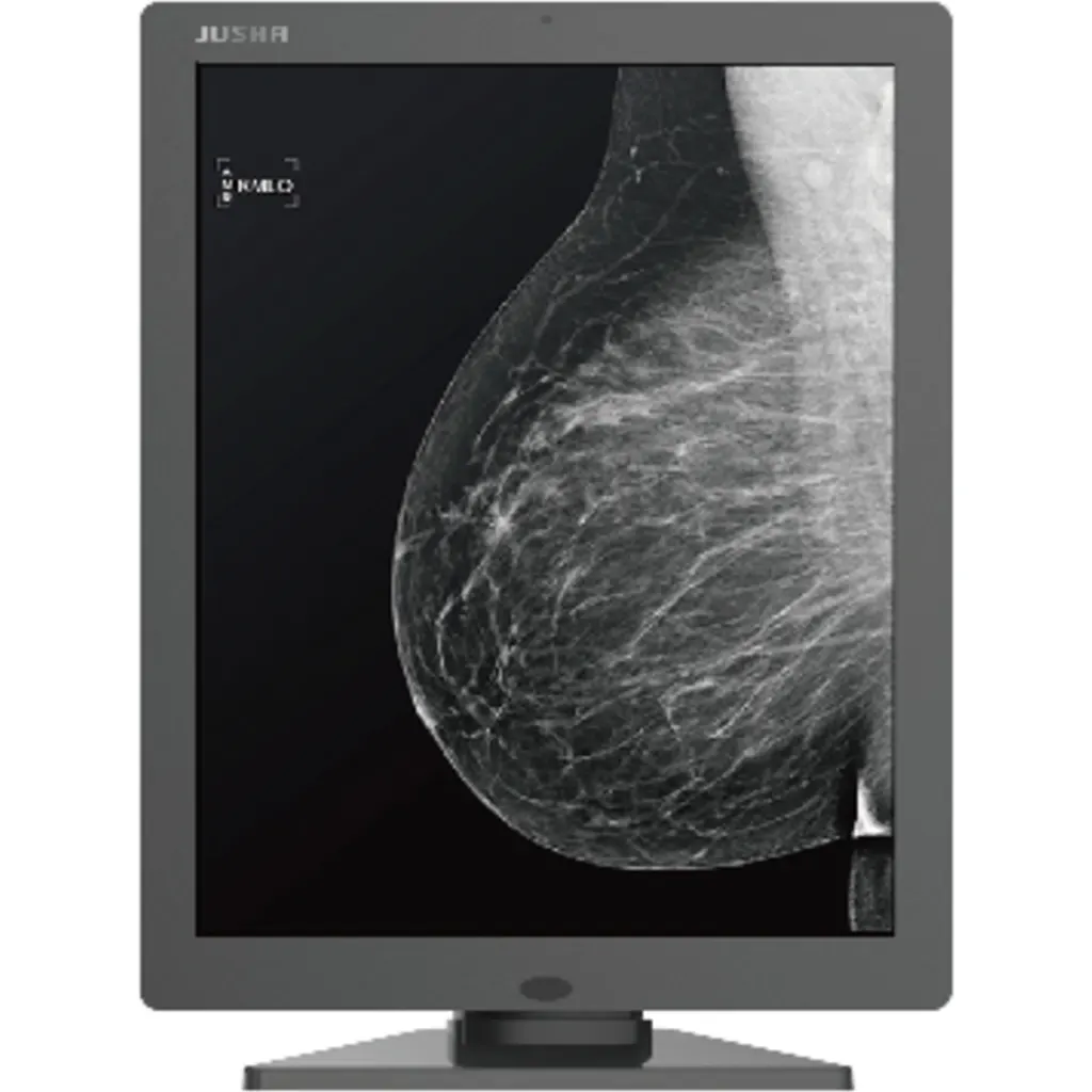 Imagen 3 de Monitor Diagnostico Mamografía JUSHA M53, 21.3" 5MP Monocr 5:4 LED IPS DVI-D