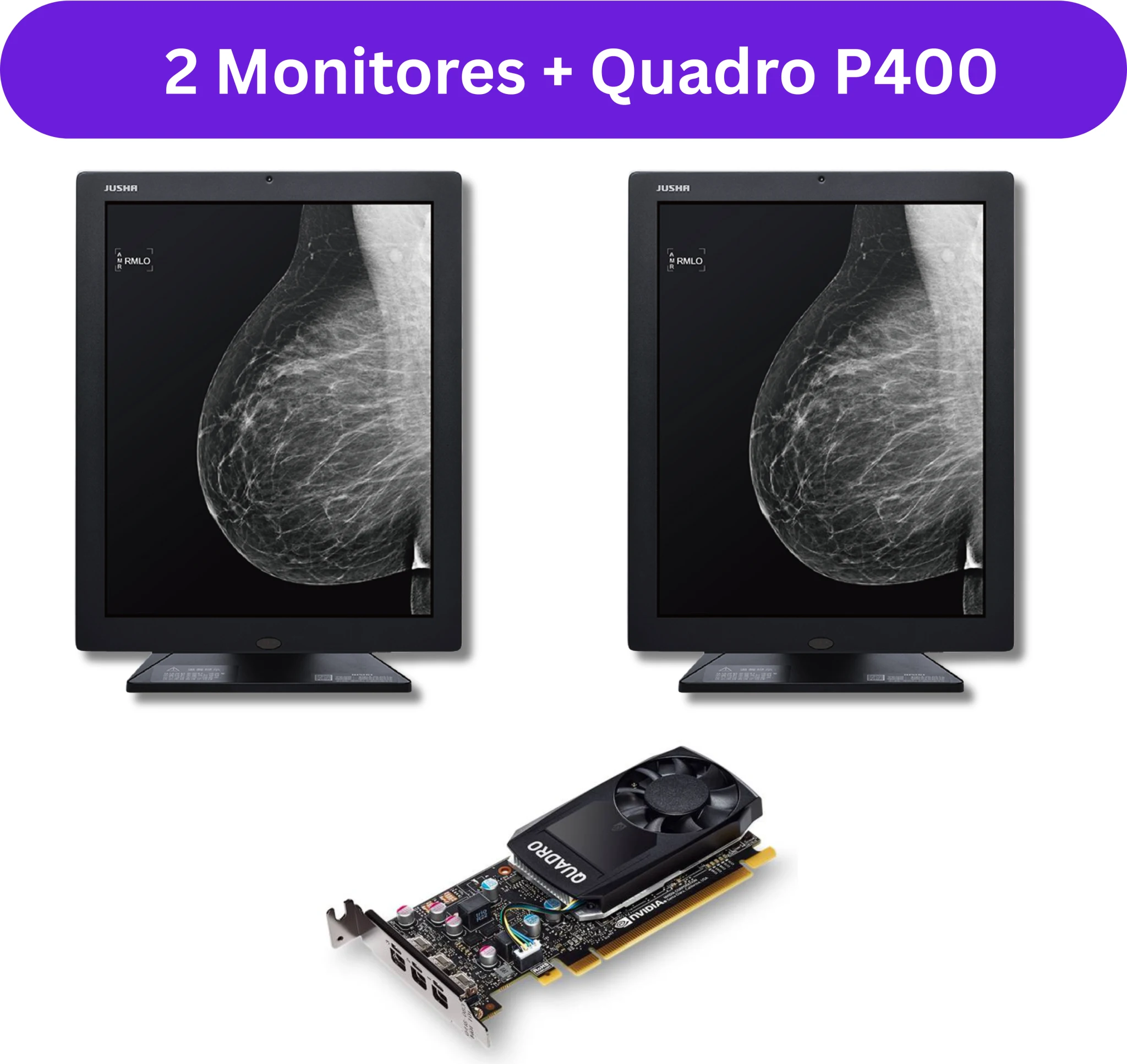 Imagen 0 de KIT Mamografía JUSHA M53, 2 X 21.3" 5MP X Monocr 5:4 LED IPS DVI-D + QUADRO P400