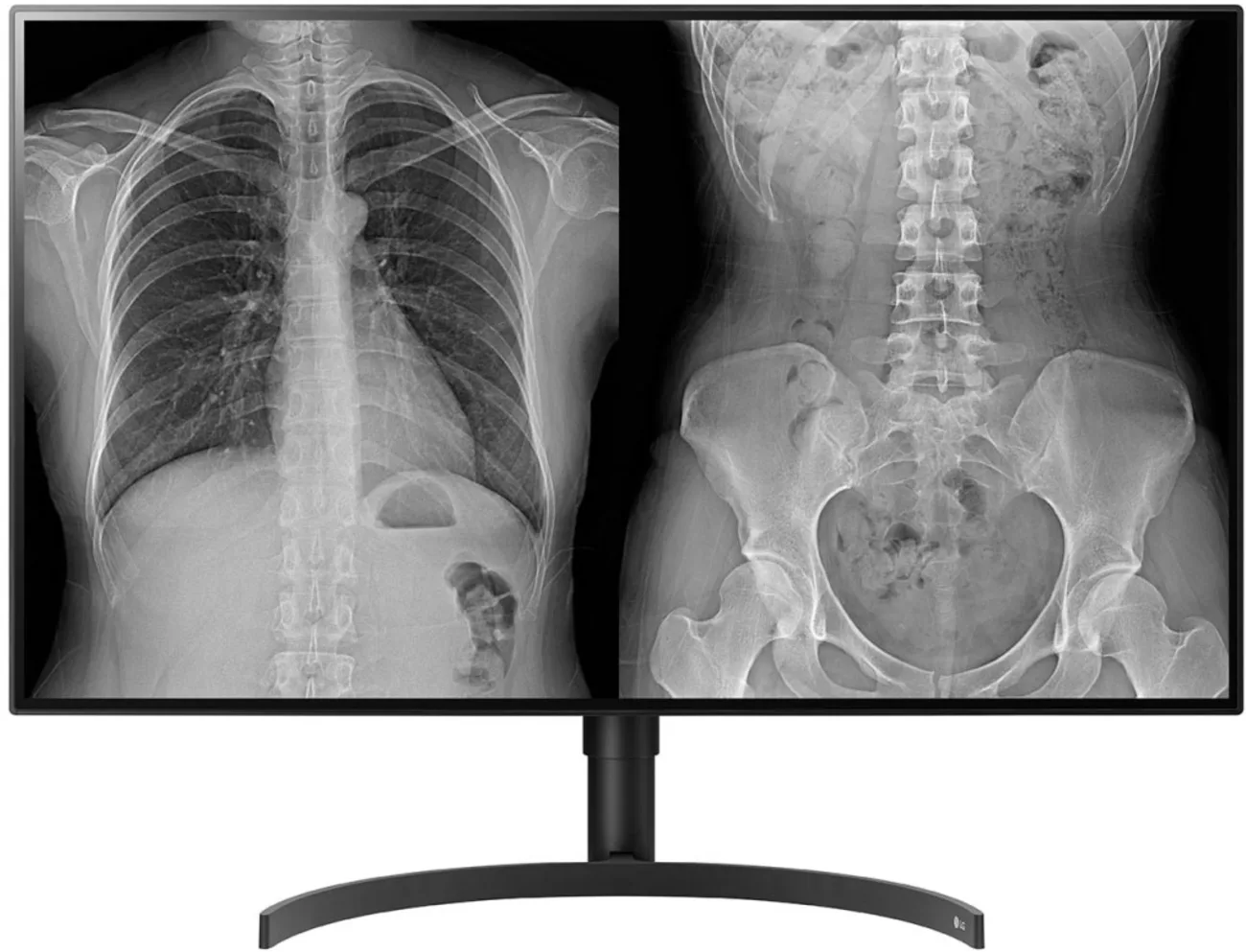 Imagen 0 de Monitor de Diagnóstico LG 32HL512D 32" 3840*2160 IPS 2*DP HDMI USB