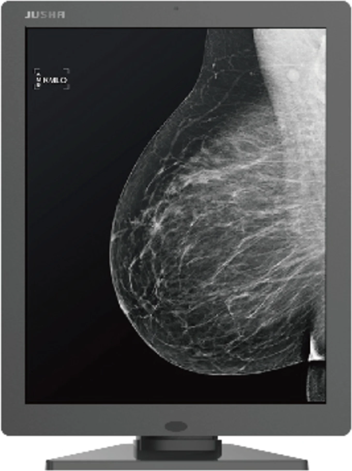 Imagen 4 de KIT Mamografía JUSHA M53, 2 X 21.3" 5MP X Monocr 5:4 LED IPS DVI-D + QUADRO P400