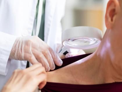 Тамбовские онкологи проведут акции по предупреждению рака кожи и молочной железы