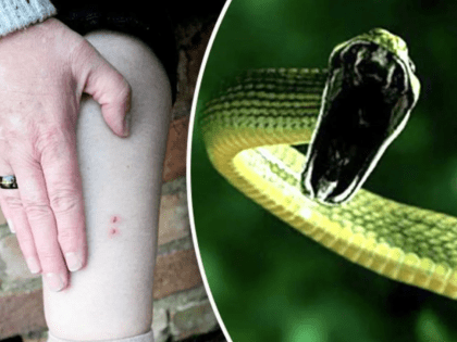 Тамбовчан предупреждают о смертельной опасности при укусе гадюки