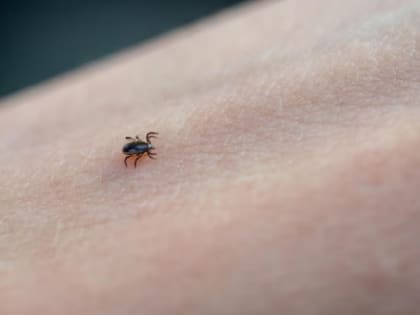 За неделю от укусов клещей пострадали 107 тамбовчан