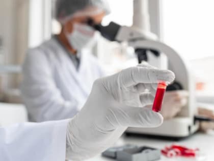 Роспотребнадзор рассказал о случаях заражения листериозом