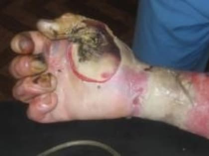 АЛКОГОЛЬ – ВРАГ ЗДОРОВЬЯ!