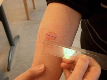 Туберкулезтан уругларны камгалаңар!