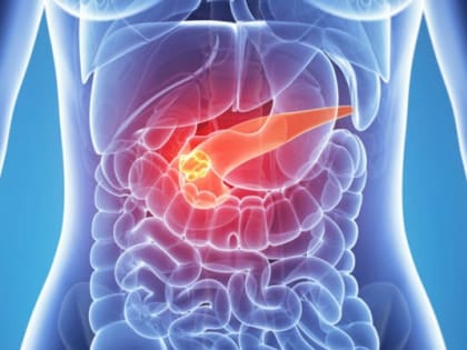 АЛКОГОЛЬНЫЙ ПАНКРЕАТИТ