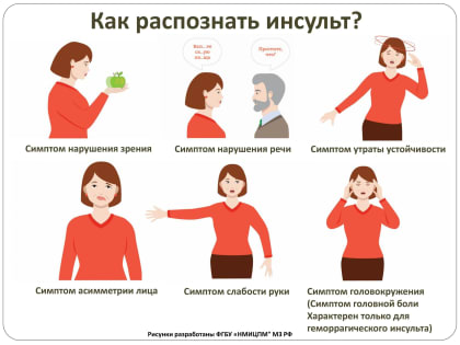 Как определить инсульт?