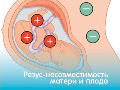 РЕЗУС-НЕСОВМЕСТИМОСТЬ МАТЕРИ И ПЛОДА
