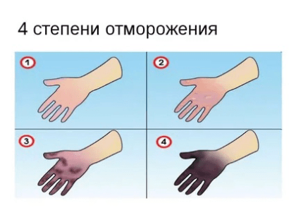 Профилактика обморожения