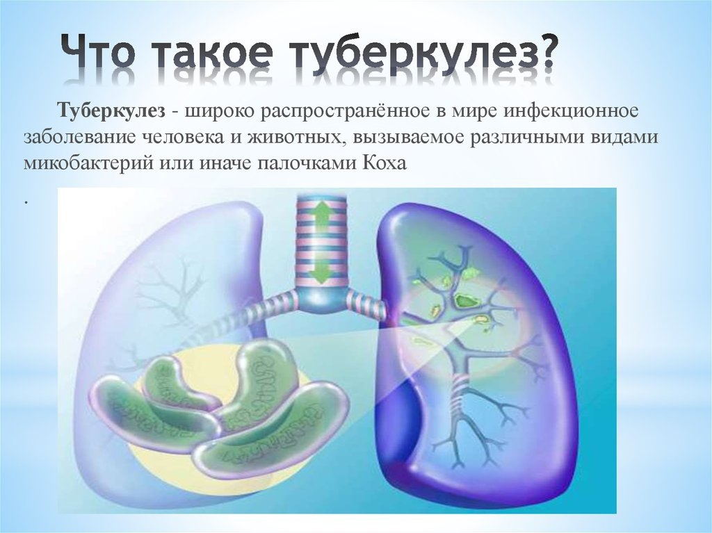 Фтизиатрия презентации. Туберкулез презентация. Туберкулез презентация по биологии. Туберкулез у детей презентация. Презентация по туберкулезу.