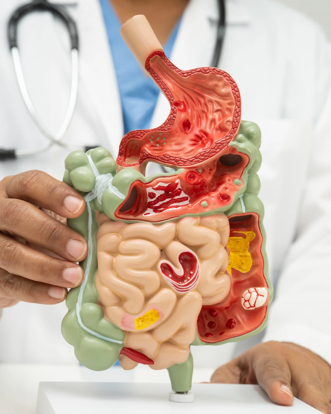 Gastroenterology