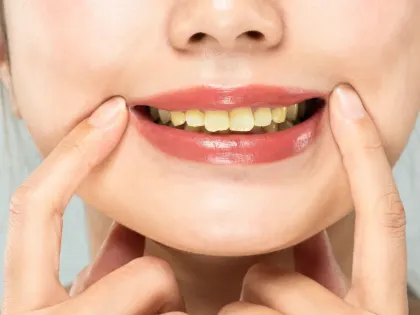 Влияние курения на здоровье полости рта