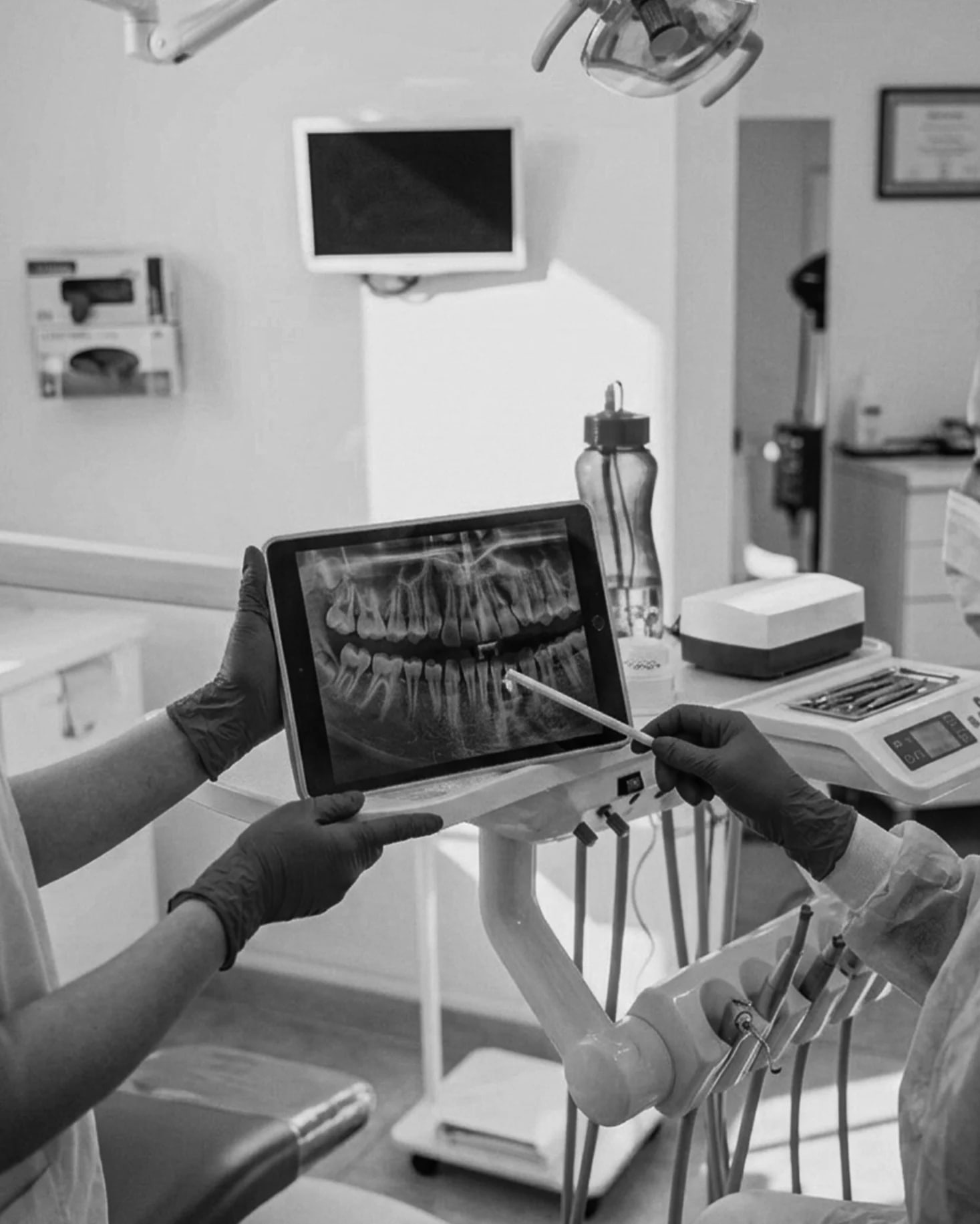 Dental Implants