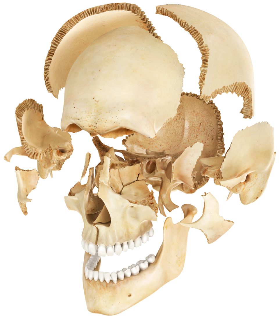 Human Skull Anatomy, Bones in Human Skull