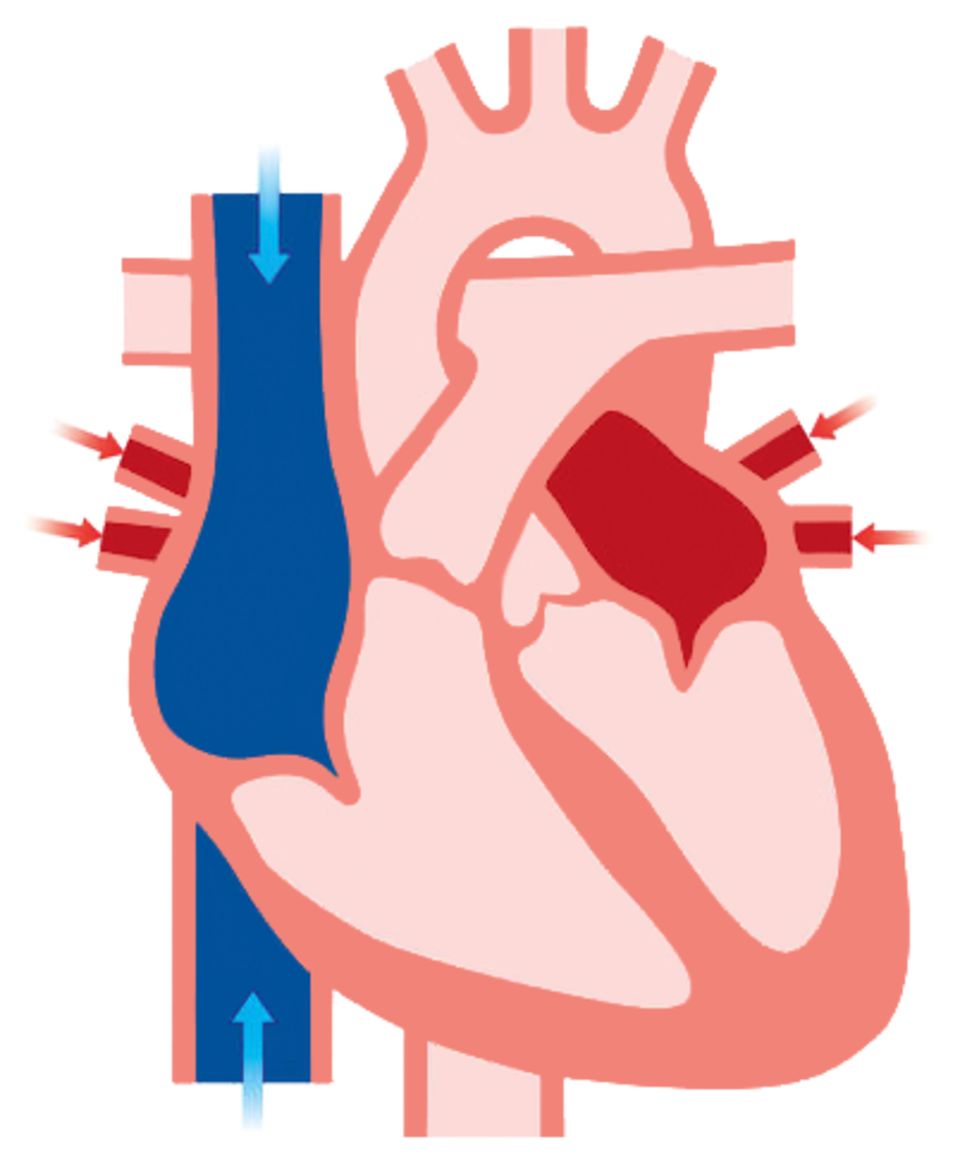 heartbeat in brain