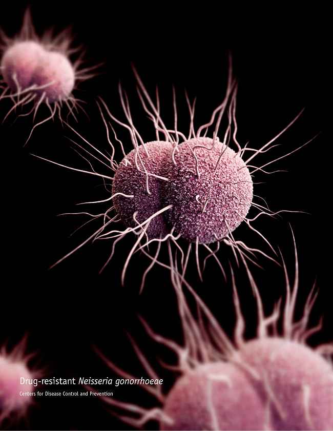 Neisseria gonorrhoeae Sumber: US Centers for Disease Control and Prevention, J Archer, PHIL CDC, 2013.