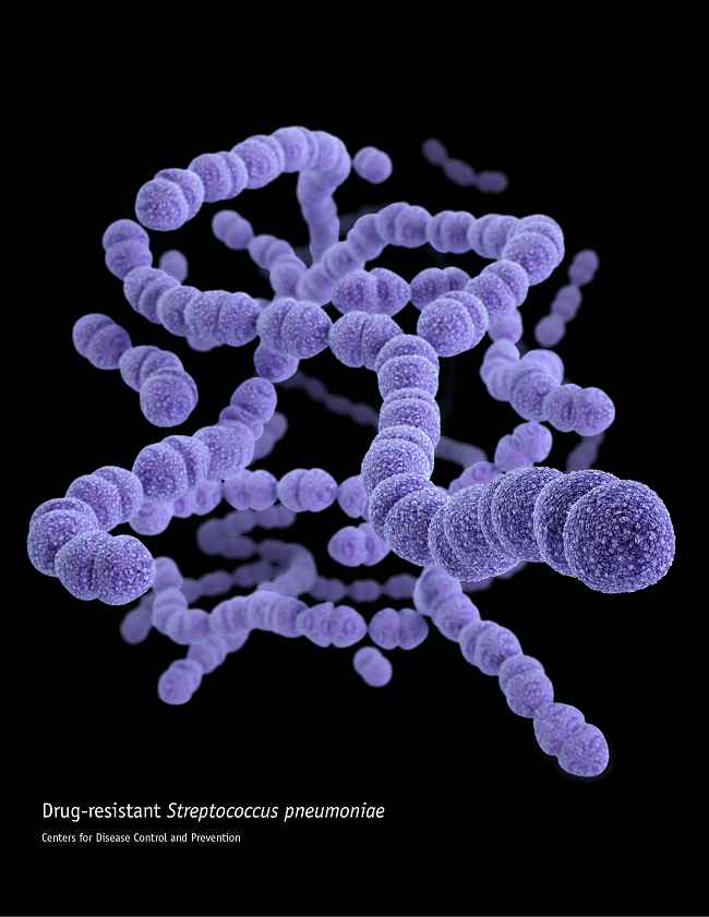 Streptococcus pneumonia. Sumber: J Archer, PHIL CDC, 2013.