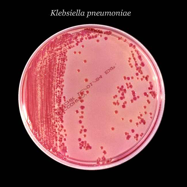 Kultur Klebsiella pneumoniae. Sumber: anonim, PHIL CDC, 1985.