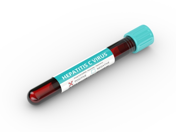 Hepatitis C