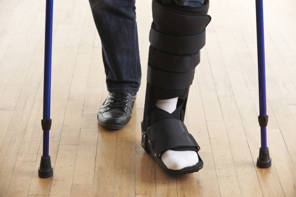 Broken Leg
