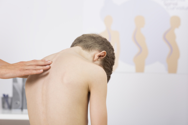 Scoliosis