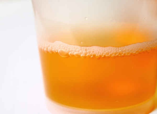 Foamy Urine