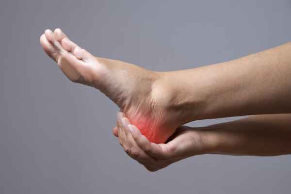 Plantar Fasciitis
