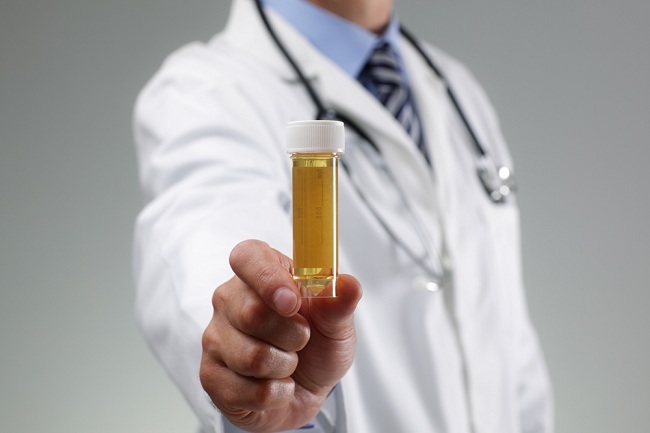 Cari Tahu Arti di Balik Warna Urine Anda - Alodokter