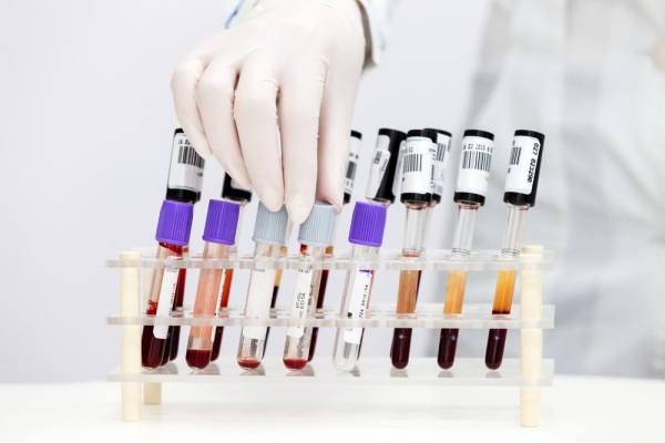 กรุ๊ปเลือด