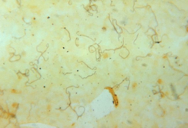 Gambaran mikroskopis Leptospira sp. Sumber: M Hicklin, PHIL CDC, 1964.