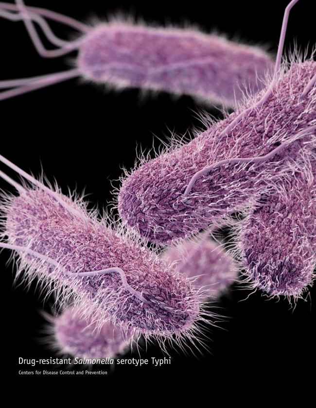 Salmonella typhi. Sumber: Archer J, CDC, 2013.