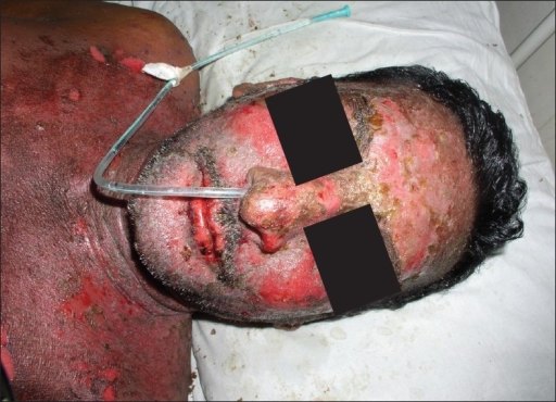 Sumber: anonim, Openi, 2011.