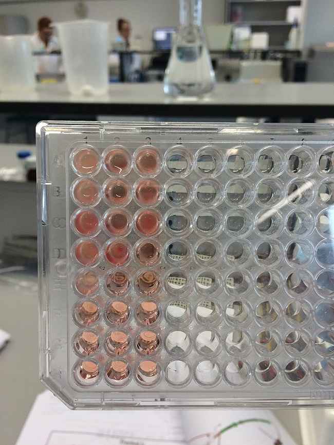 Membedakan Infeksi Bakteri Dan Virus Dengan Tes Host Protein Assay Alomedika Membedakan Infeksi Bakteri Dan Virus Dengan Tes Host Protein Assay Alomedika