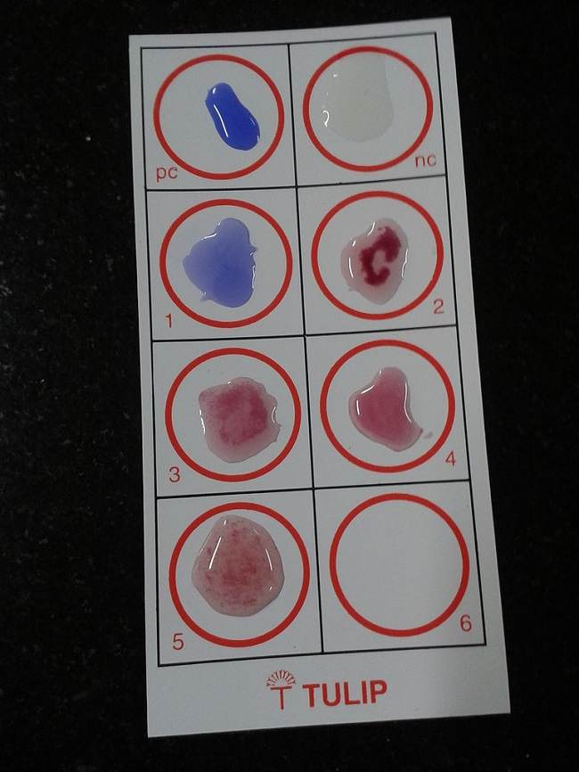 Widal Test Slide. Sumber: Sujith, Wikimedia commons, 2013.