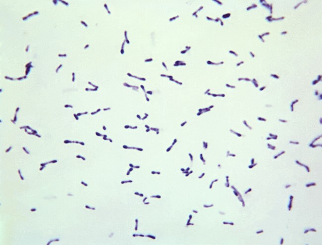 Gambaran mikroskopis Corynebacterium diphtheria dengan pewarnaan Gram. Sumber: Graham Heid, PHIL CDC, 1965.