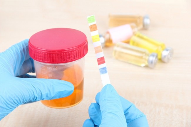 coma itu diabetes cetoacidosis coma