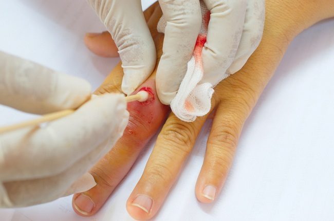 diabetes mellitus peradangan