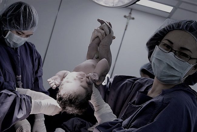 Kelahiran Per Vaginam Pasca Operasi Caesar Vaginal Birth After Caesarean Section Alomedika