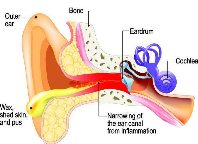 Otitis Eksterna Gejala Penyebab Dan Mengobati Alodokter