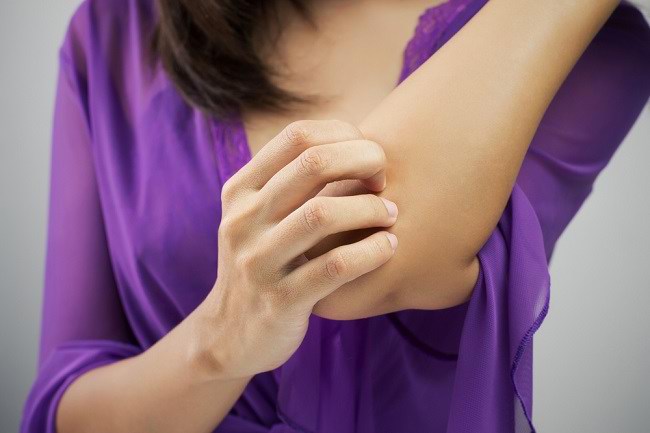 Berbagai Penyakit Kulit yang Sering Terjadi di Indonesia - Alodokter